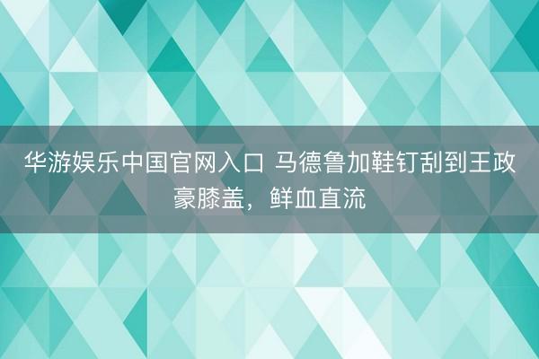 华游娱乐中国官网入口 马德鲁加鞋钉刮到王政豪膝盖，鲜血直流
